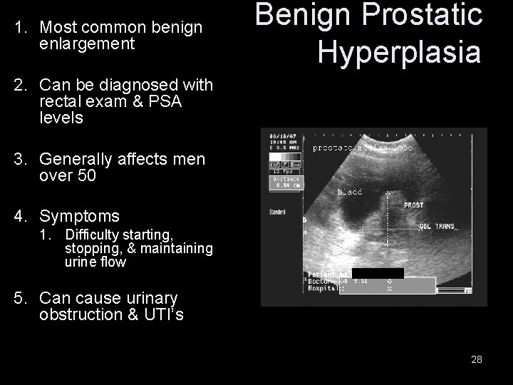 1. Most common benign enlargement Benign Prostatic Hyperplasia 2. Can be diagnosed with rectal