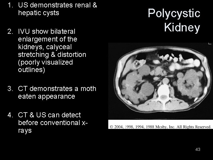 1. US demonstrates renal & hepatic cysts 2. IVU show bilateral enlargement of the