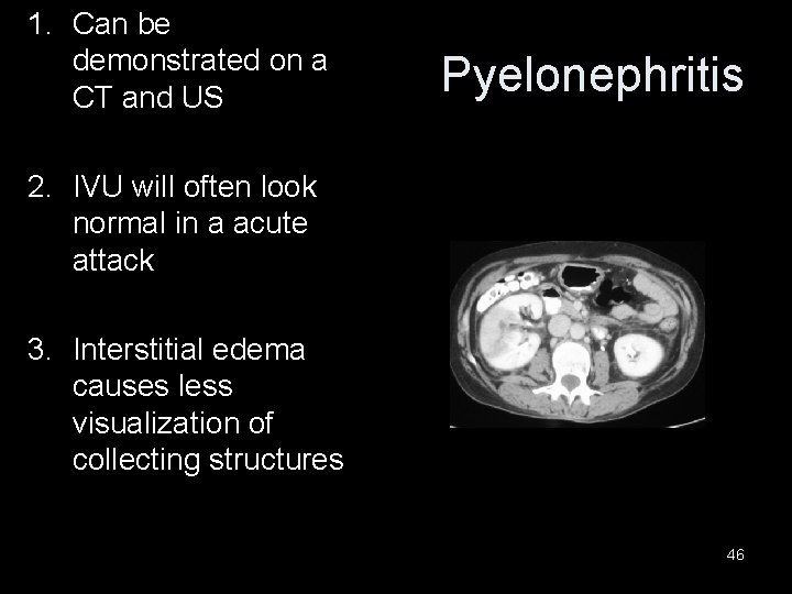 1. Can be demonstrated on a CT and US Pyelonephritis 2. IVU will often