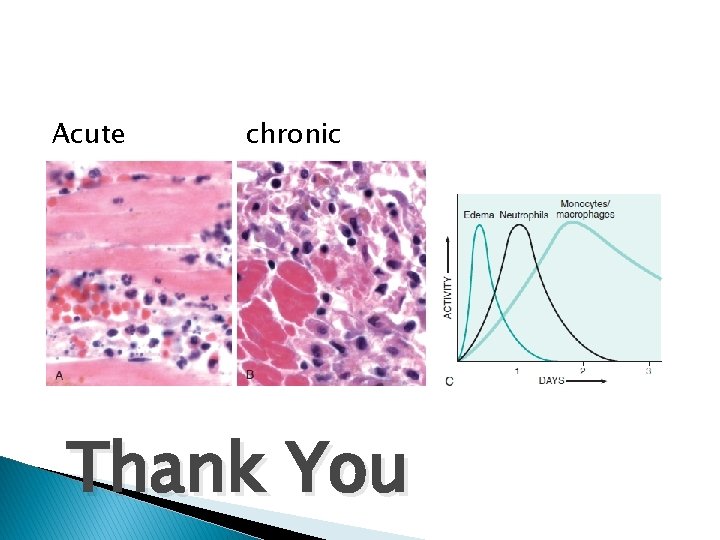 Acute chronic Thank You Acute chronic Thank You