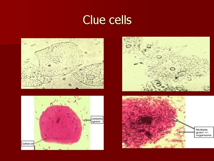 Clue cells 