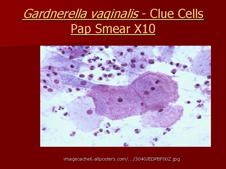 Gardnerella vaginalis - Clue Cells Pap Smear X 10 imagecache 6. allposters. com/. .