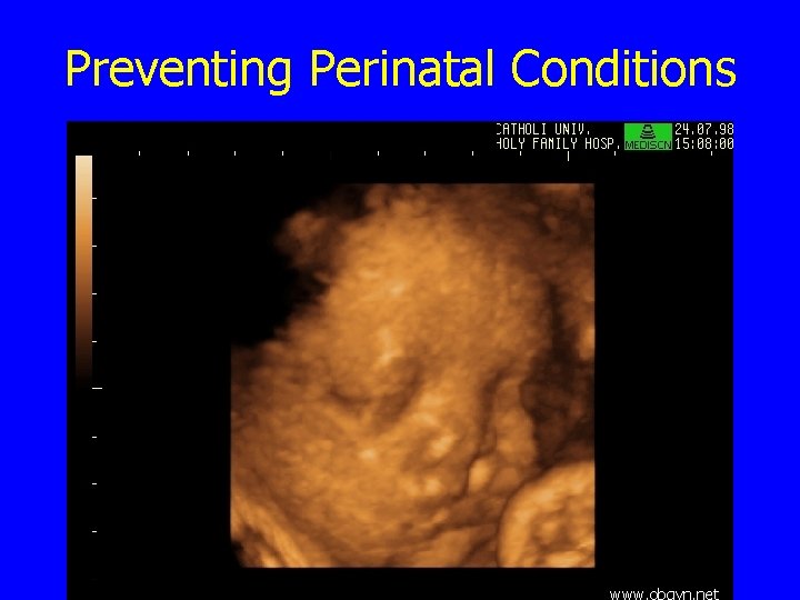 Preventing Perinatal Conditions 