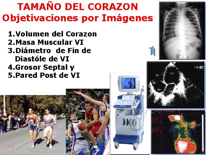 TAMAÑO DEL CORAZON Objetivaciones por Imágenes 1. Volumen del Corazon 2. Masa Muscular VI