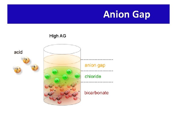 Anion Gap High AG 