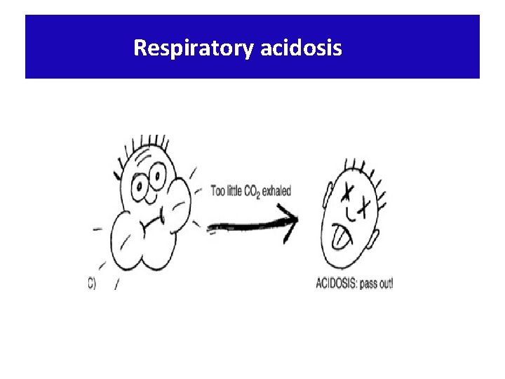 Respiratory acidosis 