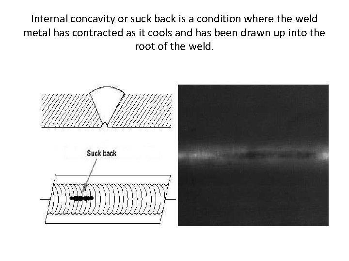 Internal concavity or suck back is a condition where the weld metal has contracted