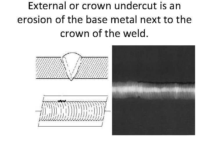 External or crown undercut is an erosion of the base metal next to the