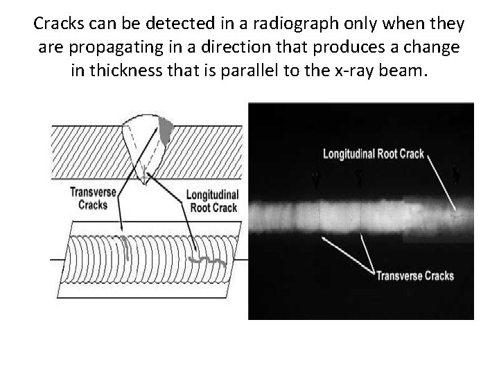 Cracks can be detected in a radiograph only when they are propagating in a