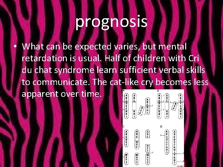 prognosis • What can be expected varies, but mental retardation is usual. Half of
