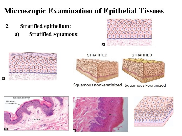 Microscopic Examination of Epithelial Tissues 2. Stratified epithelium: a) Stratified squamous: 