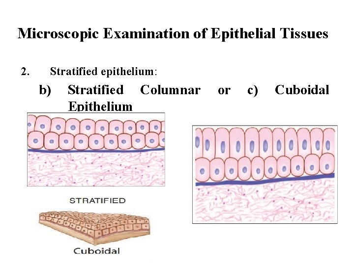 Microscopic Examination of Epithelial Tissues 2. Stratified epithelium: b) Stratified Columnar Epithelium or c)