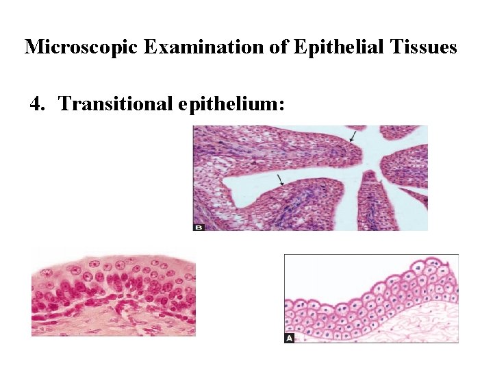 Microscopic Examination of Epithelial Tissues 4. Transitional epithelium: 
