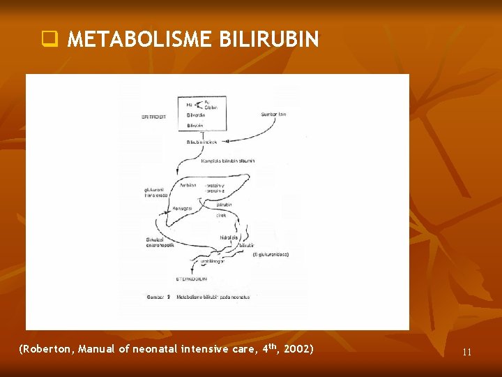 q METABOLISME BILIRUBIN (Roberton, Manual of neonatal intensive care, 4 th, 2002) 11 