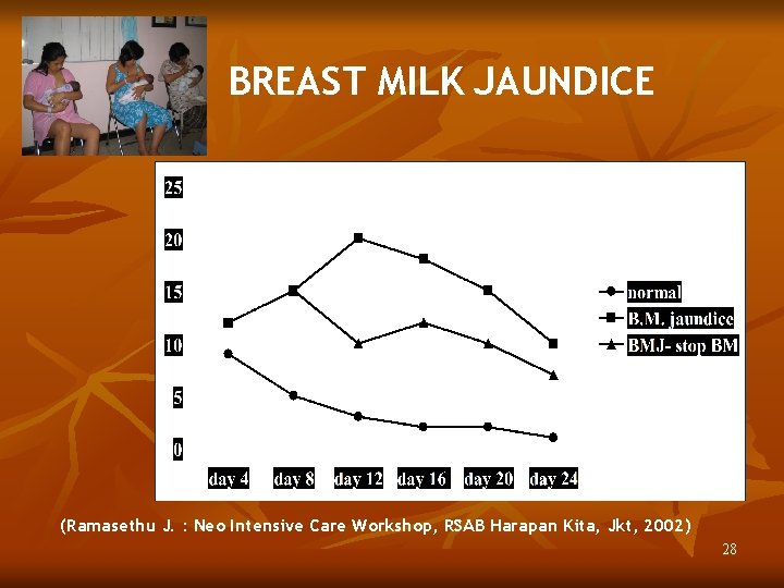 BREAST MILK JAUNDICE (Ramasethu J. : Neo Intensive Care Workshop, RSAB Harapan Kita, Jkt,
