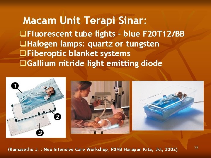 Macam Unit Terapi Sinar: q. Fluorescent tube lights - blue F 20 T 12/BB