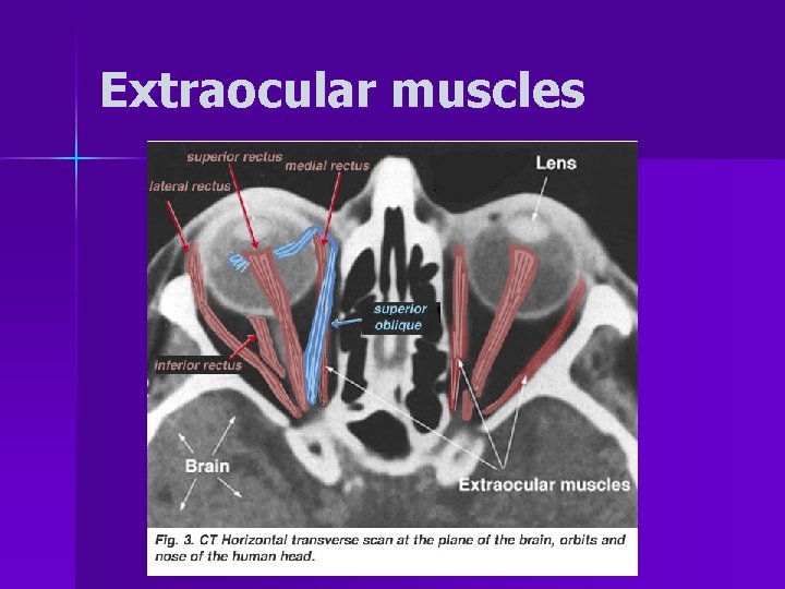 Extraocular muscles 