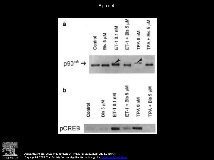 Figure 4 J Invest Dermatol 2002 118316 -322 DOI: (10. 1046/j. 0022 -202 x.