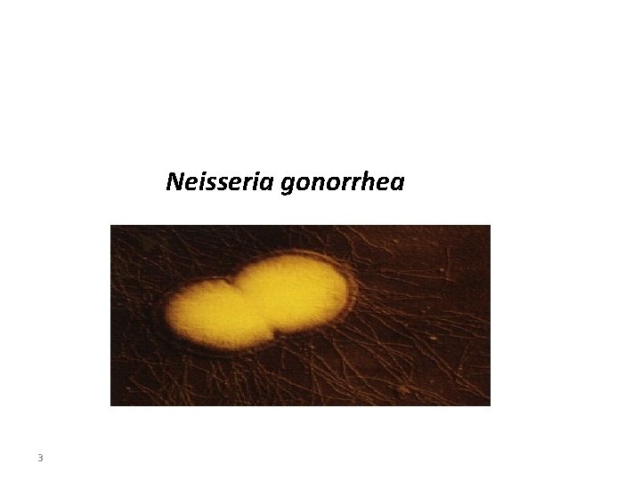 Neisseria gonorrhea 3 