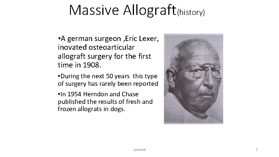 Massive Allograft(history) • A german surgeon , Eric Lexer, inovated osteoarticular allograft surgery for