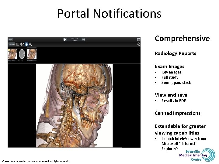 Portal Notifications Comprehensive Radiology Reports Exam Images • • • Key images Full study