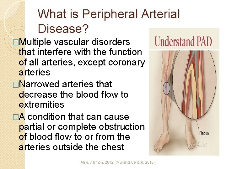 What is Peripheral Arterial Disease? �Multiple vascular disorders that interfere with the function of