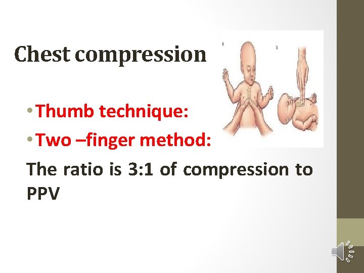 Chest compression • Thumb technique: • Two –finger method: The ratio is 3: 1
