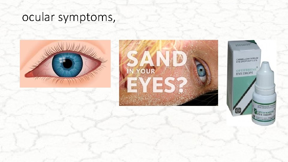 ocular symptoms, 