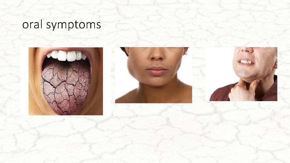 oral symptoms 