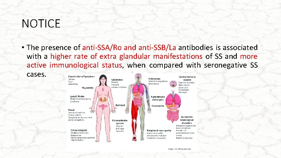 NOTICE • The presence of anti-SSA/Ro and anti-SSB/La antibodies is associated with a higher