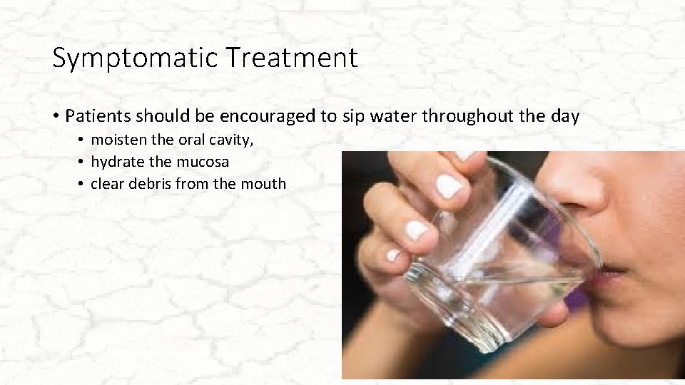 Symptomatic Treatment • Patients should be encouraged to sip water throughout the day •