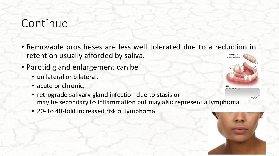 Continue • Removable prostheses are less well tolerated due to a reduction in retention