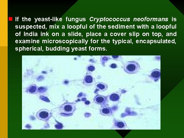 n If the yeast-like fungus Cryptococcus neoformans is suspected, mix a loopful of the