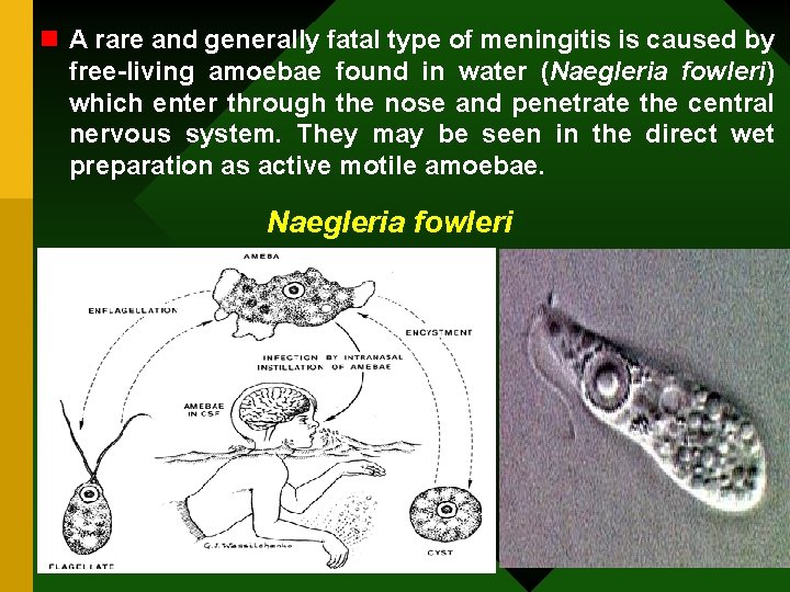 n A rare and generally fatal type of meningitis is caused by free-living amoebae