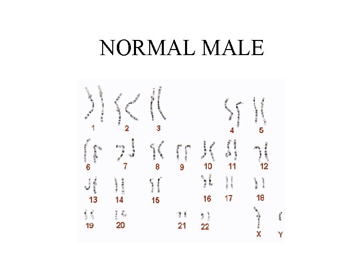 NORMAL MALE 