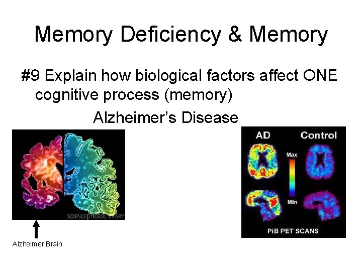 Memory Deficiency & Memory #9 Explain how biological factors affect ONE cognitive process (memory)