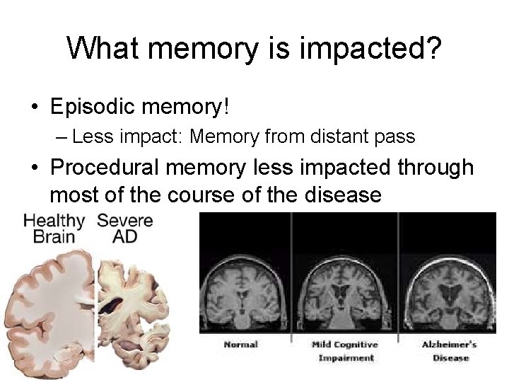 What memory is impacted? • Episodic memory! – Less impact: Memory from distant pass