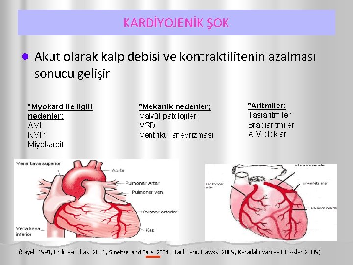 KARDİYOJENİK ŞOK l Akut olarak kalp debisi ve kontraktilitenin azalması sonucu gelişir *Myokard ile