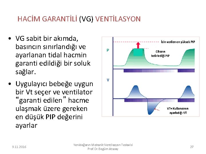 HACİM GARANTİLİ (VG) VENTİLASYON • VG sabit bir akımda, basıncın sınırlandığı ve ayarlanan tidal