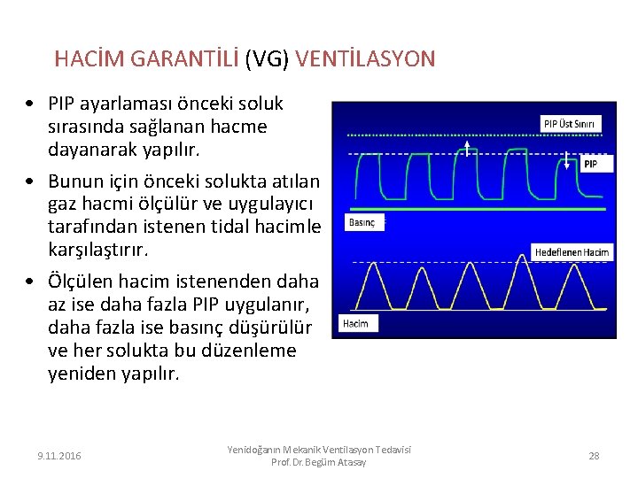 HACİM GARANTİLİ (VG) VENTİLASYON • PIP ayarlaması önceki soluk sırasında sağlanan hacme dayanarak yapılır.