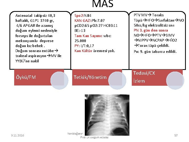 MAS Antenatal takipsiz 40, 3 haftalık, G 1 P 1 3740 gr, 4/6 APGAR