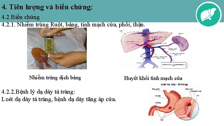 4. Tiên lượng và biến chứng: 4. 2 Biến chứng 4. 2. 1. Nhiễm