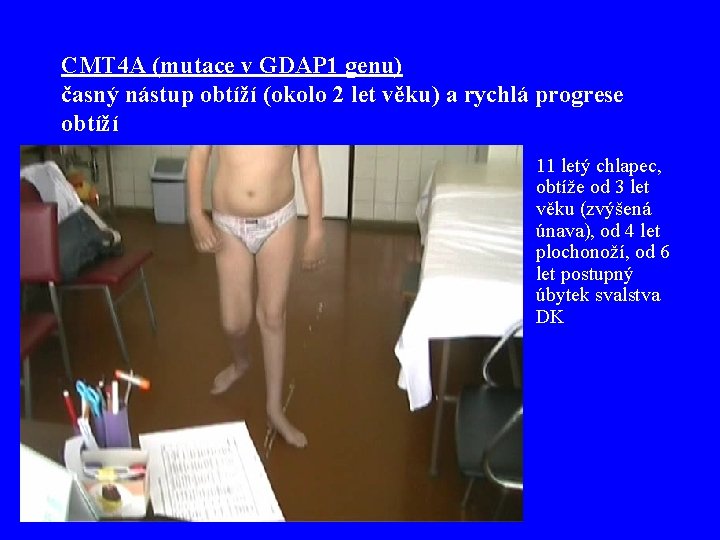 CMT 4 A (mutace v GDAP 1 genu) časný nástup obtíží (okolo 2 let