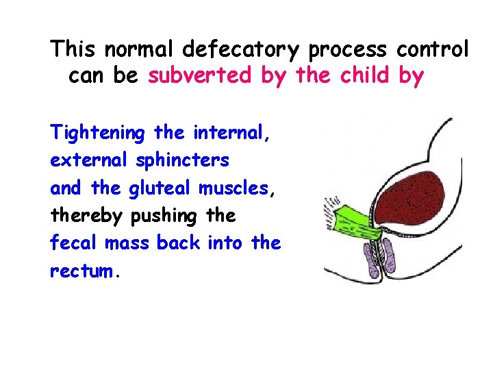 This normal defecatory process control can be subverted by the child by Tightening the