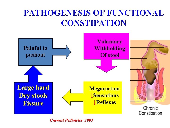 PATHOGENESIS OF FUNCTIONAL CONSTIPATION Voluntary Withholding Of stool Painful to pushout Large hard Dry