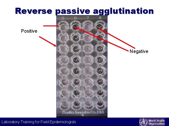 Reverse passive agglutination Positive Negative Laboratory Training for Field Epidemiologists 