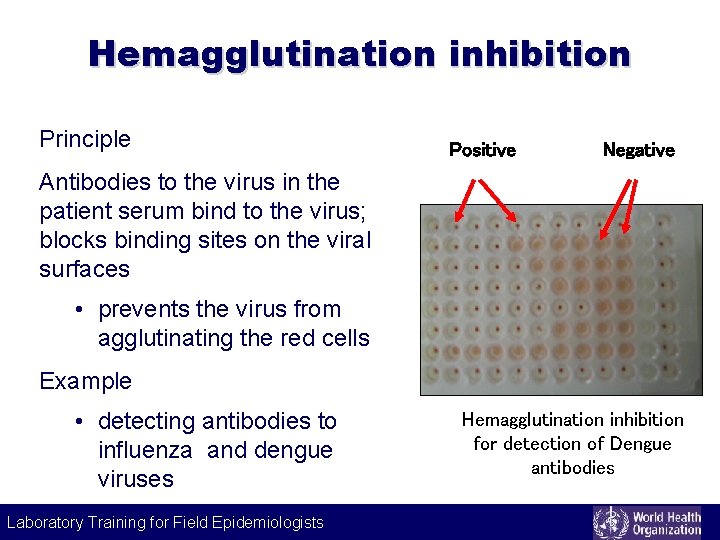 Hemagglutination inhibition Principle Positive Negative Antibodies to the virus in the patient serum bind