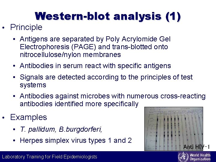 Western-blot analysis (1) • Principle • Antigens are separated by Poly Acrylomide Gel Electrophoresis