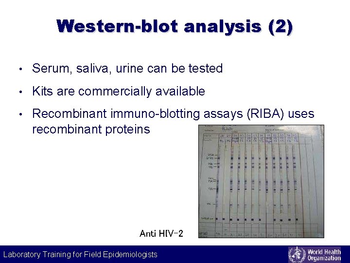 Western-blot analysis (2) • Serum, saliva, urine can be tested • Kits are commercially