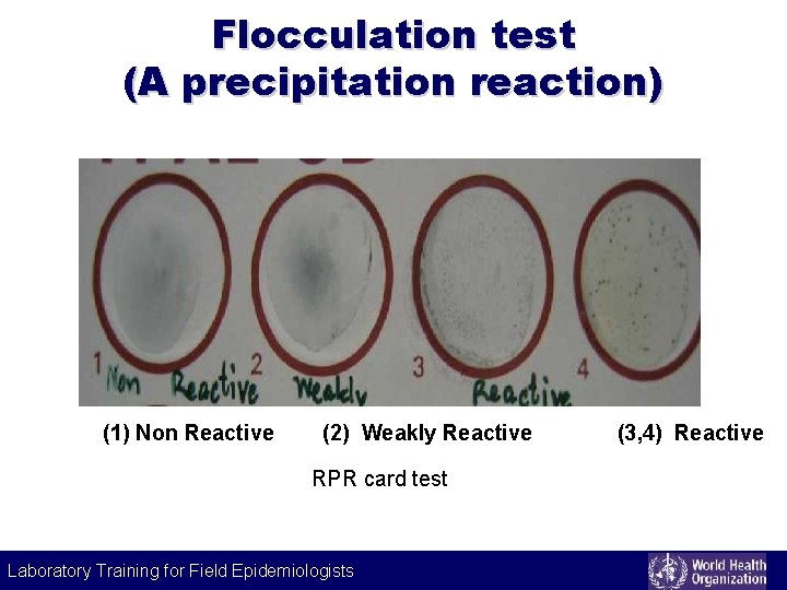 Flocculation test (A precipitation reaction) (1) Non Reactive (2) Weakly Reactive RPR card test